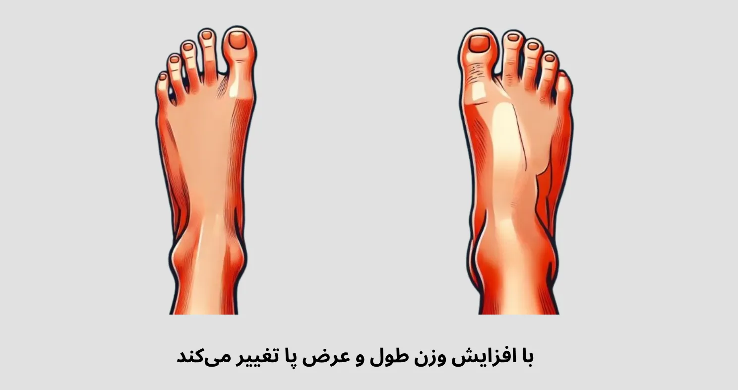 افزایش وزن یکی از علت های رشد سایز پا است